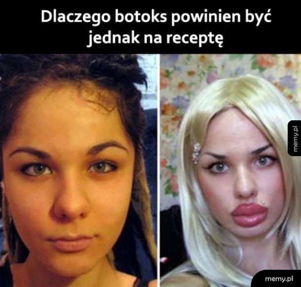 Botoks