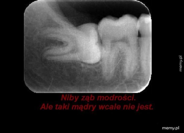 Ząb modrości.