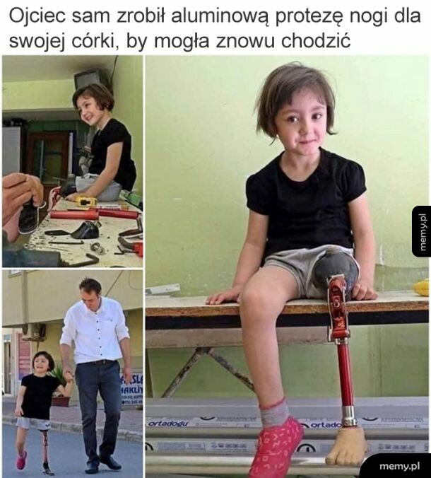 Proteza dla córki